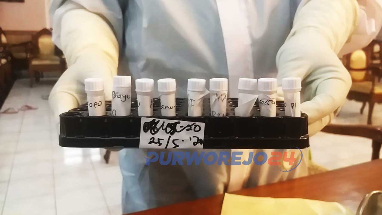 Spesimen Swab Test Covid-19