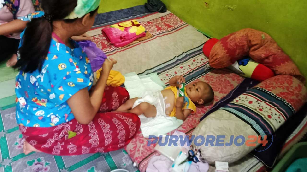 Bayi bernama Muhammad Satria Assidqi yang lahir tanpa memiliki anus membutuhkan uluran tangan